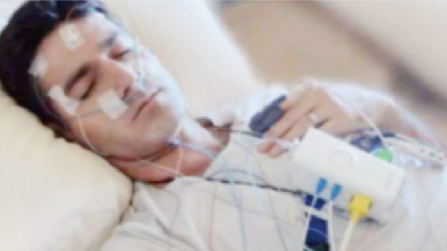哪些人需要做多导睡眠监测 哪些人需要做多导睡眠监测